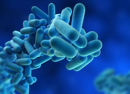 Legionnaires Disease and Infection Control