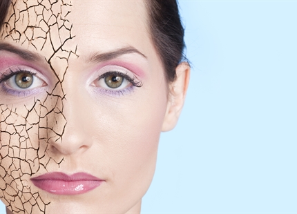 What Can Low Humidity Do to Your Skin?